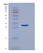 SDS-PAGE analysis of Human EEF1D (Elongation Factor 1-Delta) - Recombinant Protein, showing >95% purity under 15% SDS-PAGE (Reduced)