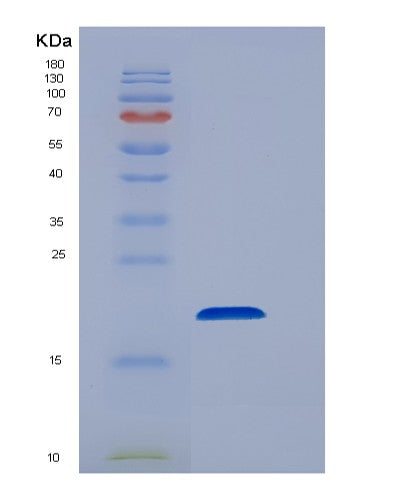SDS-PAGE analysis of Human EEF1E1 (Eukaryotic Translation Elongation Factor 1 Epsilon-1) - Recombinant Protein, showing >90% purity under 15% SDS-PAGE (Reduced)