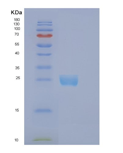 SDS-PAGE analysis of Human EFNB1 (Ephrin-B1) - Recombinant Protein, showing >85% purity under 15% SDS-PAGE (Reduced)