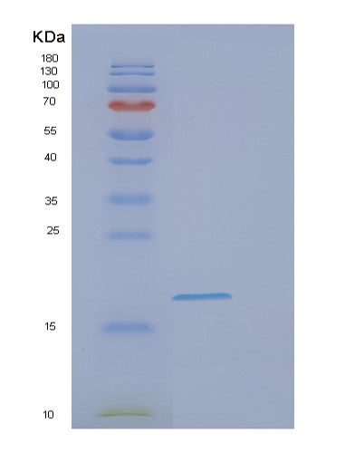 SDS-PAGE analysis of Human EIF1AX (Eukaryotic Translation Initiation Factor 1A, X-Chromosomal) - Recombinant Protein, showing >95% purity under 15% SDS-PAGE (Reduced)