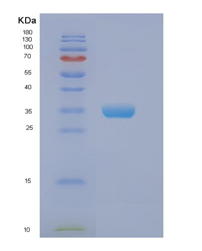 SDS-PAGE analysis of Human EIF2B1 (Translation Initiation Factor Eif2B Subunit Alpha) - Recombinant Protein, showing >95% purity under 15% SDS-PAGE (Reduced)