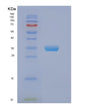 SDS-PAGE analysis of Human EIF2B1 (Translation Initiation Factor Eif2B Subunit Alpha) - Recombinant Protein, showing >95% purity under 15% SDS-PAGE (Reduced)