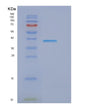 SDS-PAGE analysis of Human EIF3I (Eukaryotic Translation Initiation Factor 3 Subunit I) - Recombinant Protein, showing >95% purity under 15% SDS-PAGE (Reduced)