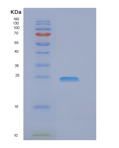 SDS-PAGE analysis of Human EIF3J (Eukaryotic Translation Initiation Factor 3 Subunit J) - Recombinant Protein, showing >90% purity under 15% SDS-PAGE (Reduced)
