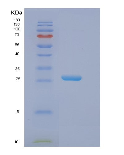 SDS-PAGE analysis of Human EIF3K (Eukaryotic Translation Initiation Factor 3 Subunit K) - Recombinant Protein, showing >85% purity under 15% SDS-PAGE (Reduced)