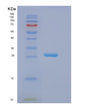 SDS-PAGE analysis of Human EIF3K (Eukaryotic Translation Initiation Factor 3 Subunit K) - Recombinant Protein, showing >85% purity under 15% SDS-PAGE (Reduced)