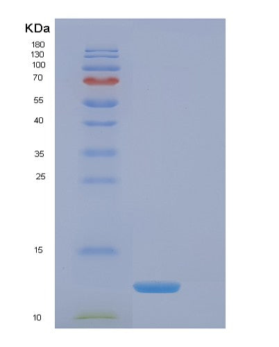 SDS-PAGE analysis of Human EIF4EBP3 (Eukaryotic Translation Initiation Factor 4E-Binding Protein 3) - Recombinant Protein, showing >85% purity under 15% SDS-PAGE (Reduced)