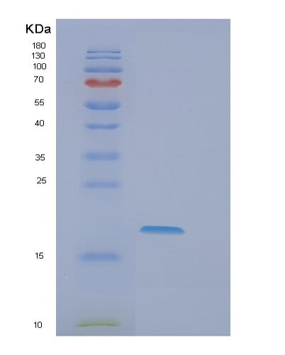 SDS-PAGE analysis of Human EIF5A2 (Eukaryotic Translation Initiation Factor 5A-2) - Recombinant Protein, showing >90% purity under 15% SDS-PAGE (Reduced)