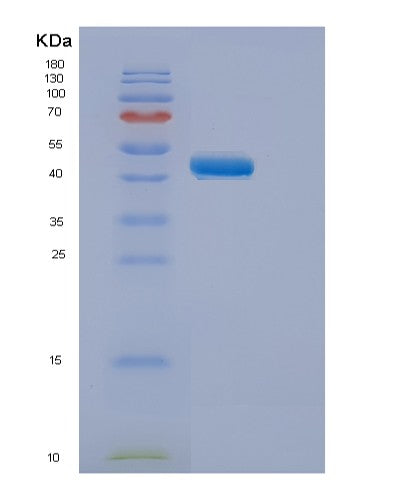 SDS-PAGE analysis of Human ELP4 (Elongator Complex Protein 4) - Recombinant Protein, showing >95% purity under 15% SDS-PAGE (Reduced)
