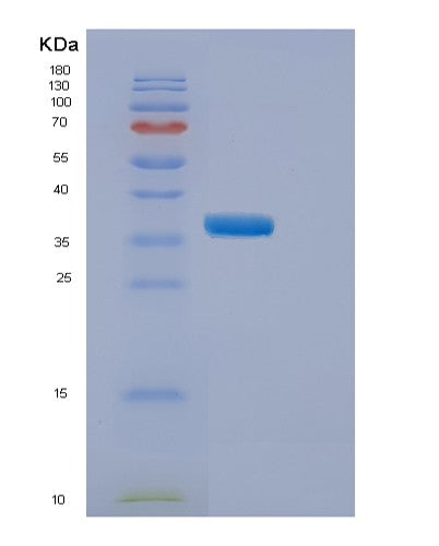 SDS-PAGE analysis of Human ELP5 (Elongator Complex Protein 5) - Recombinant Protein, showing >90% purity under 15% SDS-PAGE (Reduced)