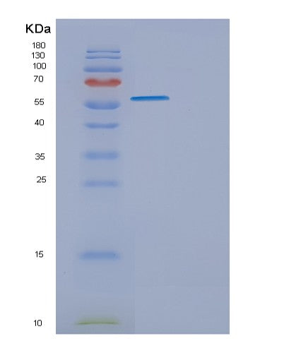 SDS-PAGE analysis of Mouse Eng (Endoglin) - Recombinant Protein, showing >90% purity under 15% SDS-PAGE (Reduced)