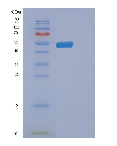 SDS-PAGE analysis of Human ENTPD3 (Ectonucleoside Triphosphate Diphosphohydrolase 3) - Recombinant Protein, showing >90% purity under 15% SDS-PAGE (Reduced)