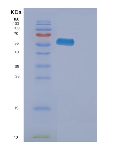 SDS-PAGE analysis of Human EPHA2 (Ephrin Type-A Receptor 2) - Recombinant Protein, showing >90% purity under 15% SDS-PAGE (Reduced)