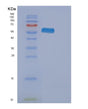 SDS-PAGE analysis of Human EPHA2 (Ephrin Type-A Receptor 2) - Recombinant Protein, showing >90% purity under 15% SDS-PAGE (Reduced)