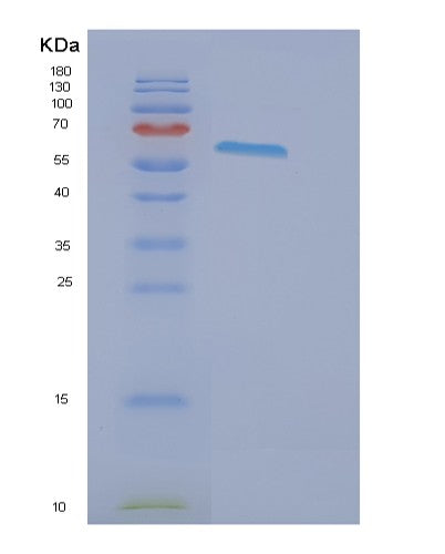 SDS-PAGE analysis of Human EPHB2 (Ephrin Type-B Receptor 2) - Recombinant Protein, showing >90% purity under 15% SDS-PAGE (Reduced)