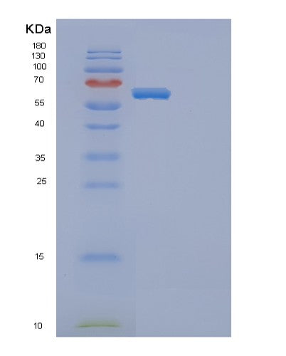 SDS-PAGE analysis of Mouse Ephb4 (Ephrin Type-B Receptor 4) - Recombinant Protein, showing >90% purity under 15% SDS-PAGE (Reduced)