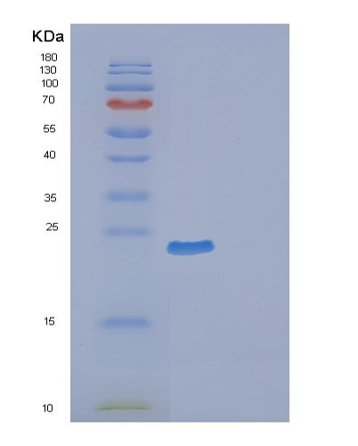 SDS-PAGE analysis of Mouse Efnb2 (Ephrin-B2) - Recombinant Protein, showing >85% purity under 15% SDS-PAGE (Reduced)