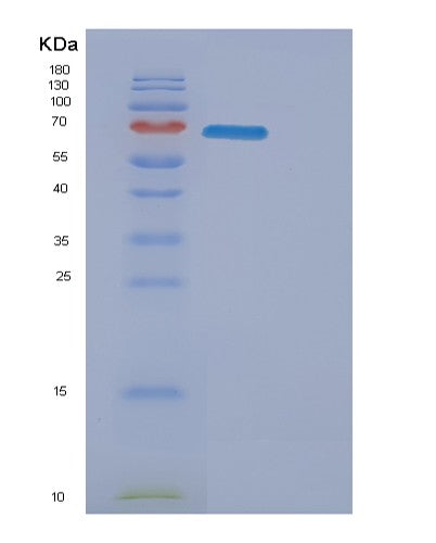 SDS-PAGE analysis of Mouse Erbb3 (Receptor Tyrosine-Protein Kinase Erbb-3) - Recombinant Protein, showing >85% purity under 15% SDS-PAGE (Reduced)