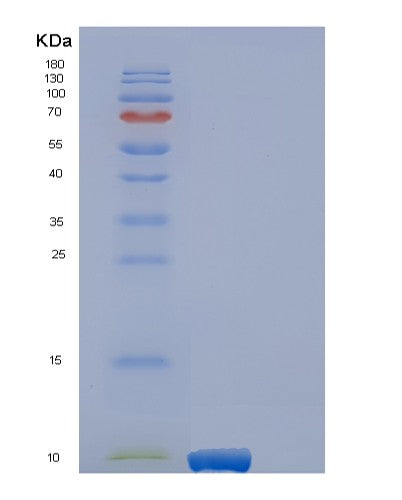 SDS-PAGE analysis of Human EREG (Proepiregulin) - Recombinant Protein, showing >85% purity under 15% SDS-PAGE (Reduced)