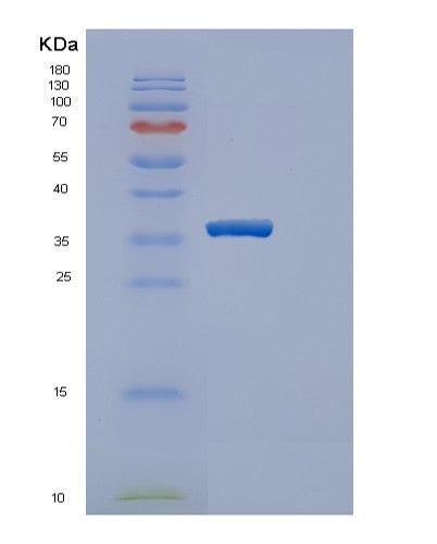 SDS-PAGE analysis of Human SULT1E1 (Sulfotransferase 1E1) - Recombinant Protein, showing >90% purity under 15% SDS-PAGE (Reduced)