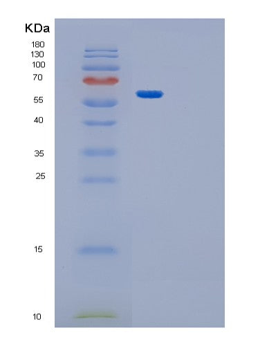 SDS-PAGE analysis of Human GPT2 (Alanine Aminotransferase 2) - Recombinant Protein, showing >90% purity under 15% SDS-PAGE (Reduced)