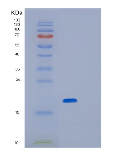 SDS-PAGE analysis of Human GPX7 (Glutathione Peroxidase 7) - Recombinant Protein, showing >85% purity under 15% SDS-PAGE (Reduced)