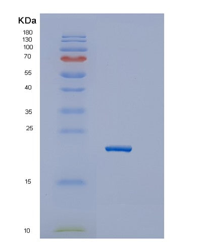 SDS-PAGE analysis of Human GUK1 (Guanylate Kinase) - Recombinant Protein, showing >85% purity under 15% SDS-PAGE (Reduced)