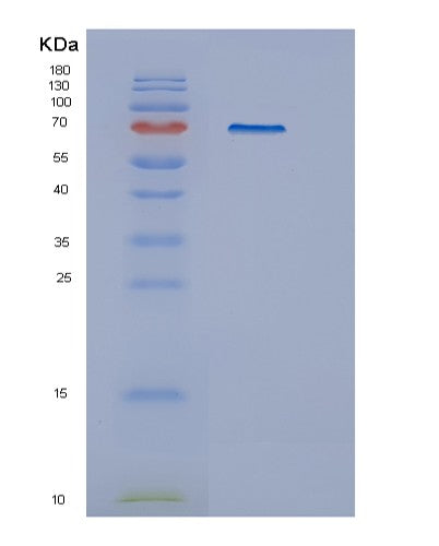 SDS-PAGE analysis of Human GUSB (Beta-Glucuronidase) - Recombinant Protein, showing >90% purity under 15% SDS-PAGE (Reduced)