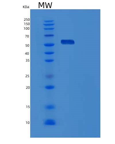 SDS-PAGE analysis of Human USH1C (Harmonin) - Recombinant Protein, showing >85% purity under 15% SDS-PAGE (Reduced)