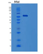 SDS-PAGE analysis of Human USH1C (Harmonin) - Recombinant Protein, showing >85% purity under 15% SDS-PAGE (Reduced)