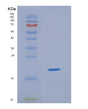 SDS-PAGE analysis of Human HBA1 (Hemoglobin Subunit Alpha) - Recombinant Protein, showing >95% purity under 15% SDS-PAGE (Reduced)