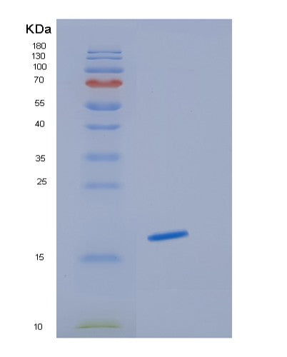 SDS-PAGE analysis of Human HBG1 (Hemoglobin Subunit Gamma-1) - Recombinant Protein, CAT# BLT-08377P showing >85% purity under 15% SDS-PAGE (Reduced)