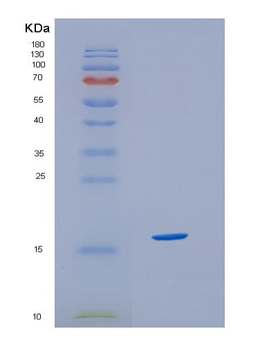 SDS-PAGE analysis of Human HBZ (Hemoglobin Subunit Zeta) - Recombinant Protein, showing >95% purity under 15% SDS-PAGE (Reduced)