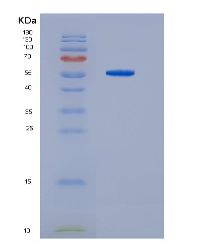 SDS-PAGE analysis of Human HDAC2 (Histone Deacetylase 2) - Recombinant Protein, CAT# BLT-08378P showing >90% purity under 15% SDS-PAGE (Reduced)
