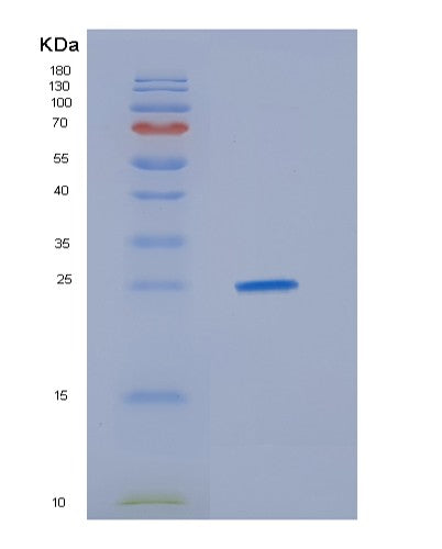 SDS-PAGE analysis of Human HDGFL3 (Hepatoma-Derived Growth Factor-Related Protein 3) - Recombinant Protein, showing >85% purity under 15% SDS-PAGE (Reduced)