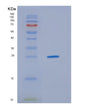 SDS-PAGE analysis of Human HDGFL3 (Hepatoma-Derived Growth Factor-Related Protein 3) - Recombinant Protein, showing >85% purity under 15% SDS-PAGE (Reduced)