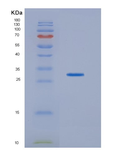 SDS-PAGE analysis of Human HDHD2 (Haloacid Dehalogenase-Like Hydrolase Domain-Containing Protein 2) - Recombinant Protein, showing >90% purity under 15% SDS-PAGE (Reduced)