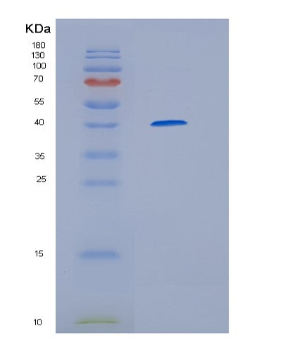 SDS-PAGE analysis of Human HERC5 (E3 Isg15--Protein Ligase Herc5) - Recombinant Protein, showing >95% purity under 15% SDS-PAGE (Reduced)