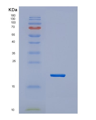 SDS-PAGE analysis of Human HES2 (Transcription Factor Hes-2) - Recombinant Protein, showing >85% purity under 15% SDS-PAGE (Reduced)