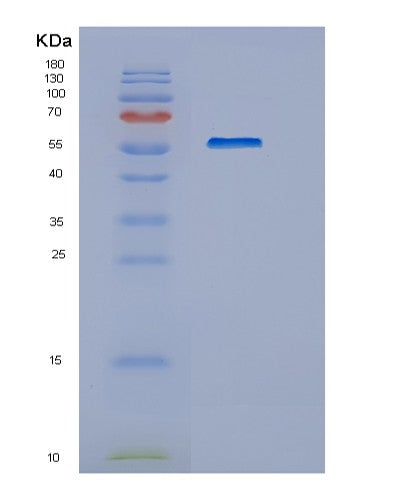 SDS-PAGE analysis of Human HEXA (Beta-Hexosaminidase Subunit Alpha) - Recombinant Protein, showing >90% purity under 15% SDS-PAGE (Reduced)