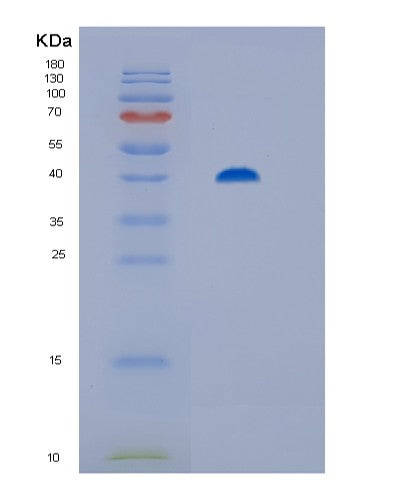SDS-PAGE analysis of Human ST13 (Hsc70-Interacting Protein) - Recombinant Protein, showing >85% purity under 15% SDS-PAGE (Reduced)