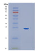 SDS-PAGE analysis of Human HLA-DOA (Hla Class Ii Histocompatibility Antigen, Do Alpha Chain) - Recombinant Protein, showing >90% purity under 15% SDS-PAGE (Reduced)