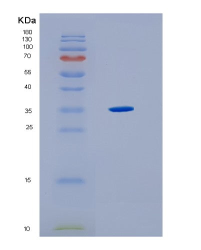SDS-PAGE analysis of Human HLA-F (Hla Class I Histocompatibility Antigen, Alpha Chain F) - Recombinant Protein, showing >85% purity under 15% SDS-PAGE (Reduced)