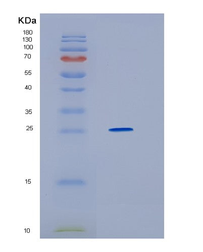 SDS-PAGE analysis of Human HMGB2 (High Mobility Group Protein B2) - Recombinant Protein, showing >85% purity under 15% SDS-PAGE (Reduced)