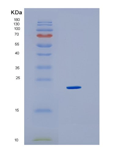SDS-PAGE analysis of Human HMGB3 (High Mobility Group Protein B3) - Recombinant Protein, showing >95% purity under 15% SDS-PAGE (Reduced)