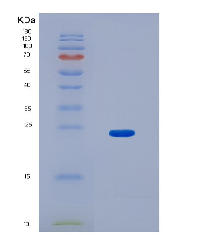 SDS-PAGE analysis of Human JPT1 (Jupiter Microtubule Associated Homolog 1) - Recombinant Protein, showing >95% purity under 15% SDS-PAGE (Reduced)
