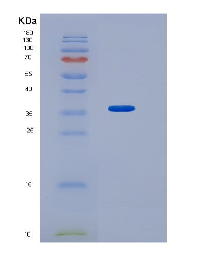 SDS-PAGE analysis of Human HNMT (Histamine N-Methyltransferase) - Recombinant Protein, showing >90% purity under 15% SDS-PAGE (Reduced)