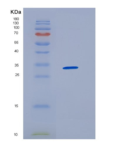 SDS-PAGE analysis of Human HNRNPAB (Heterogeneous Nuclear Ribonucleoprotein A/B) - Recombinant Protein, showing >95% purity under 15% SDS-PAGE (Reduced)