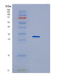 SDS-PAGE analysis of Human HNRNPK (Heterogeneous Nuclear Ribonucleoprotein K) - Recombinant Protein, showing >85% purity under 15% SDS-PAGE (Reduced)