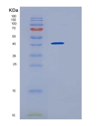 SDS-PAGE analysis of Human HOMER2 (Homer Protein Homolog 2) - Recombinant Protein, showing >90% purity under 15% SDS-PAGE (Reduced)